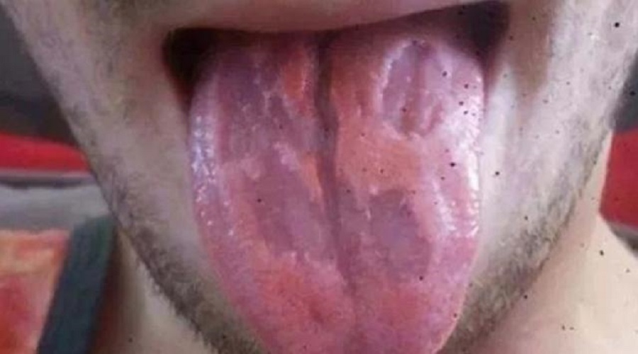 tongue_affect_for_consume_energy_drink
