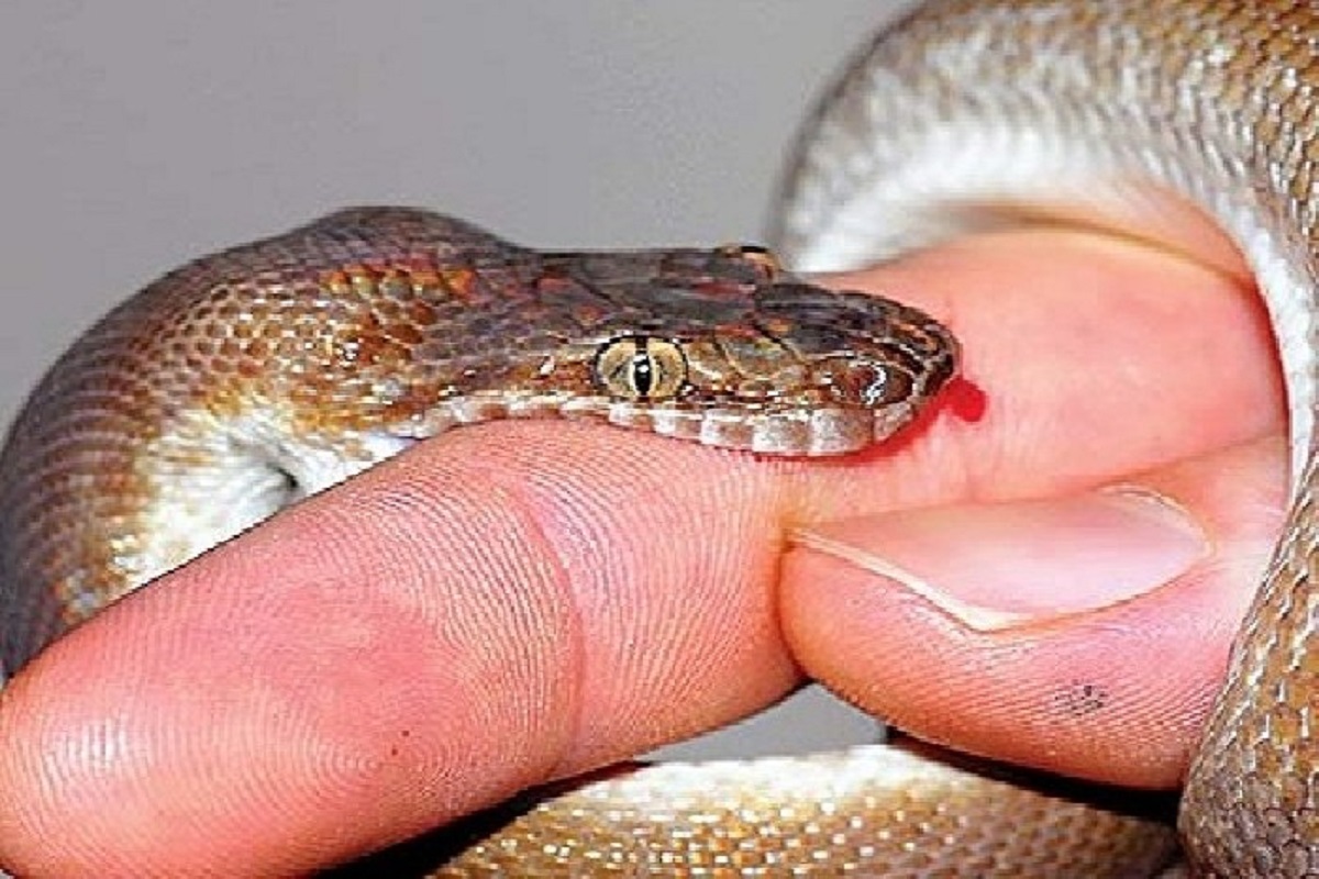 snake bite image
