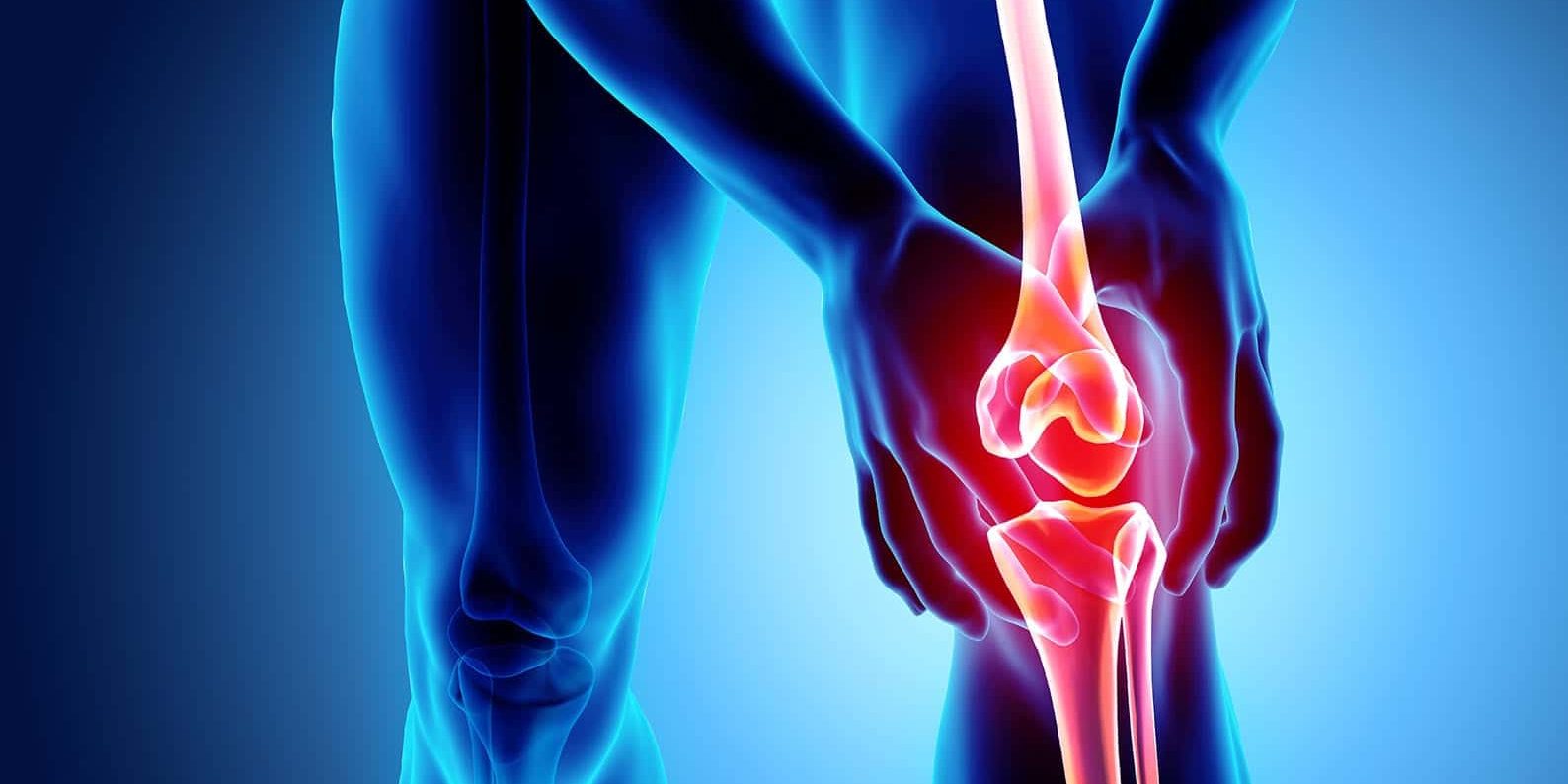knee-osteoarthritis-