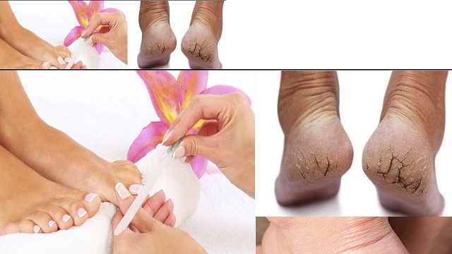foot care tips